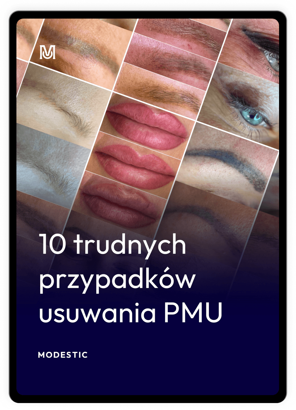 10 trudnych przypadków usuwania PMU