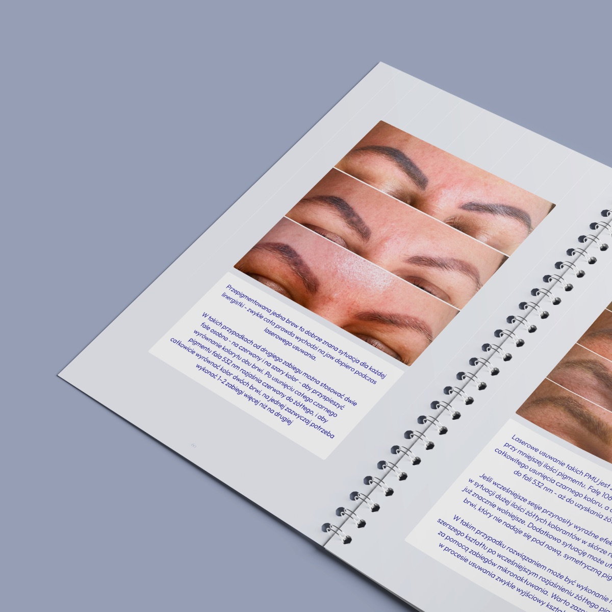 Casebook otwarty — rozkładówka