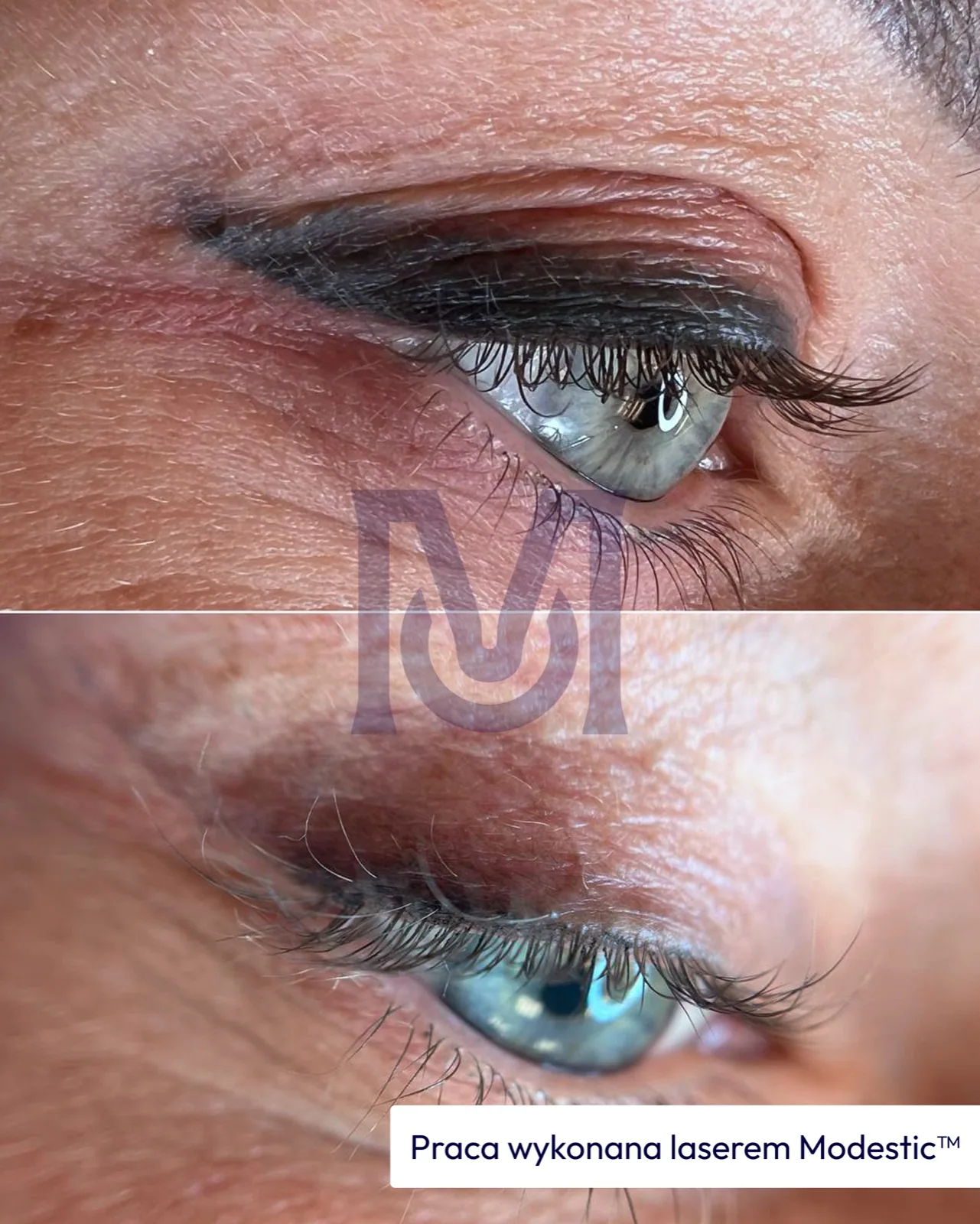 Modestic laser treatment result — brows and permanent makeup before and after