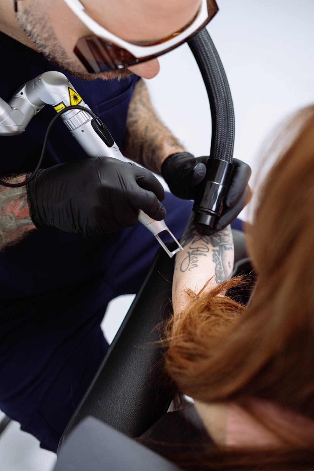 The laser tip at a tattoo on a client’s arm during treatment