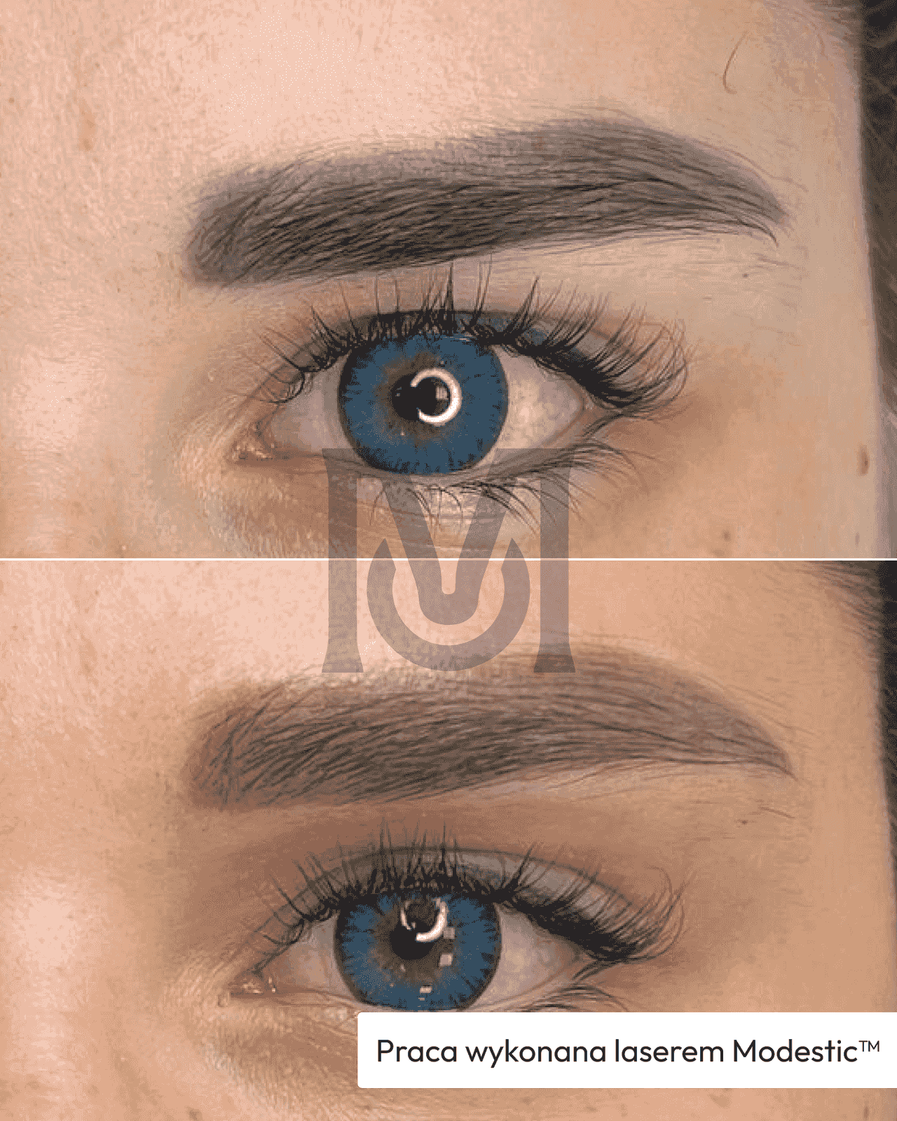 Before / after result