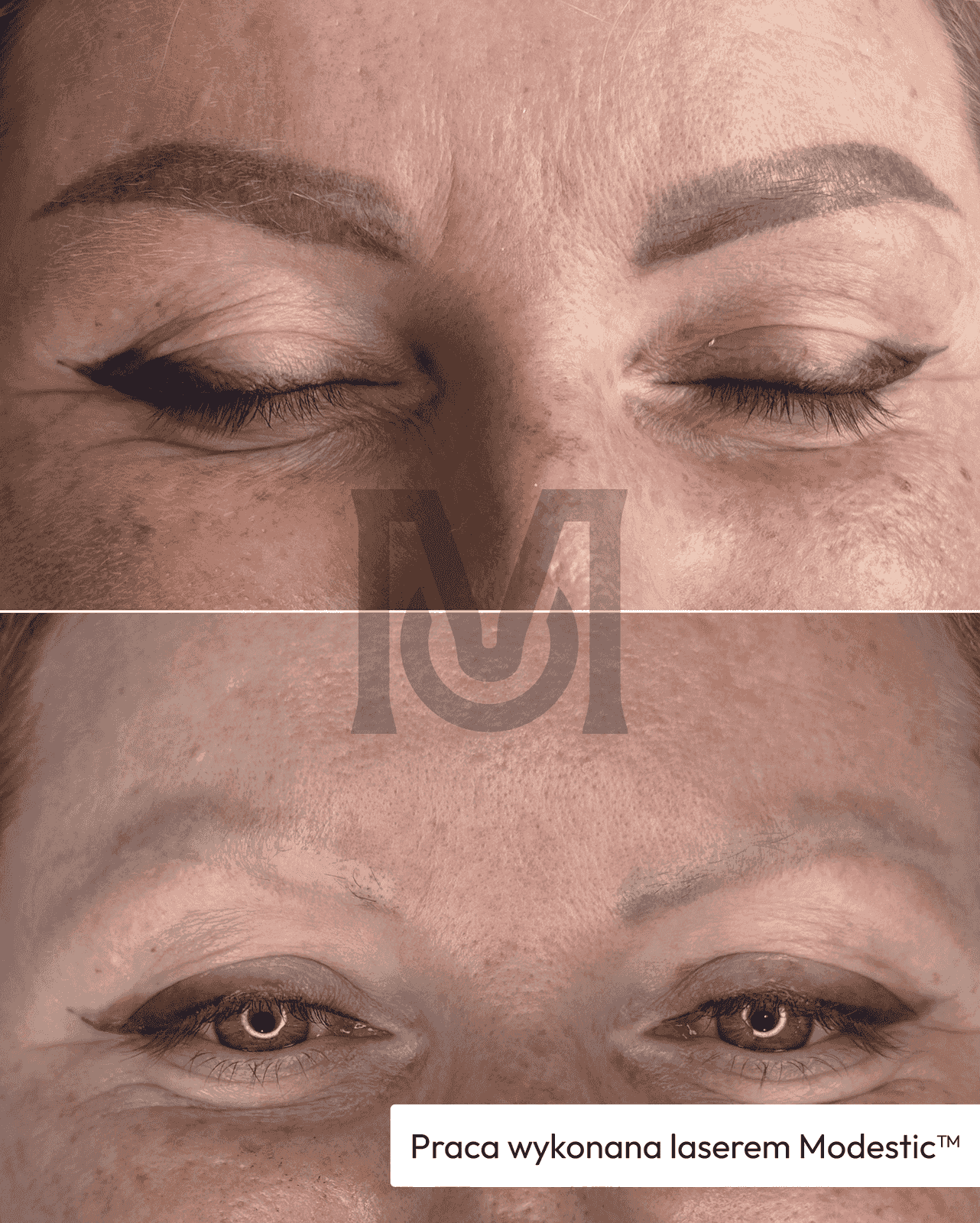 Before / after result