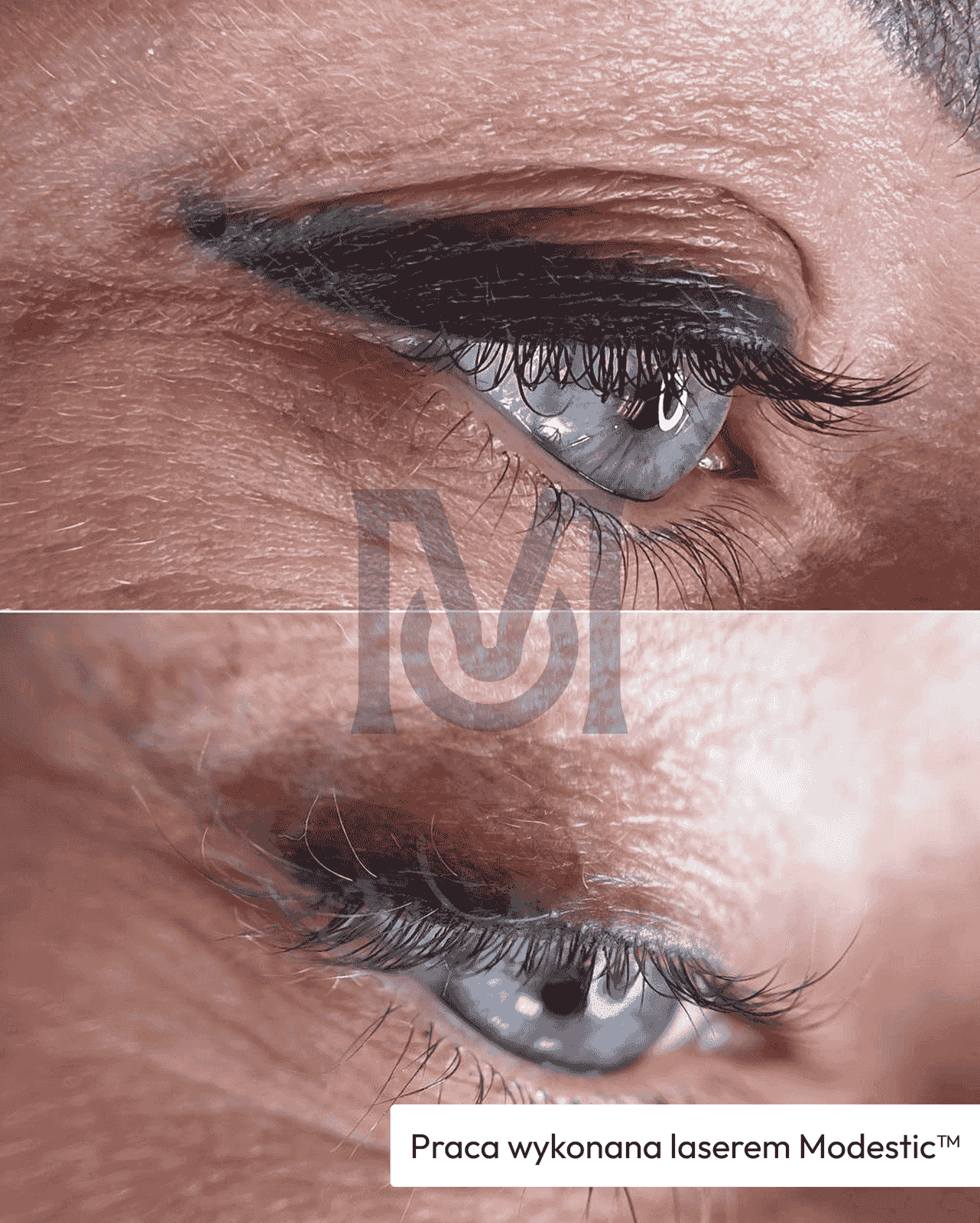 Before / after result