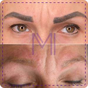 usuwanie makijażu permanentnego