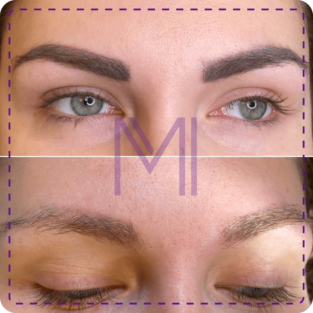 usuwanie makijażu permanentnego