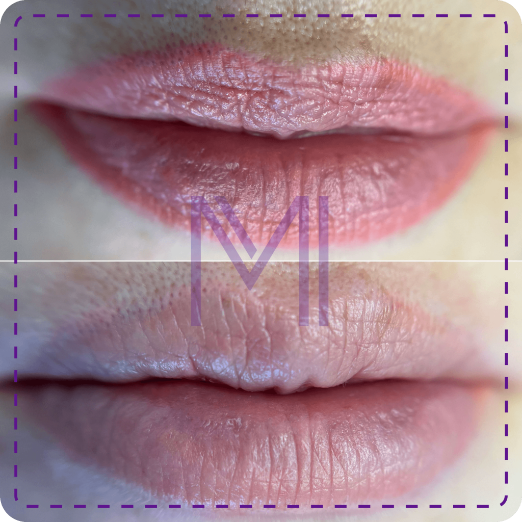 usuwanie makijażu permanentnego