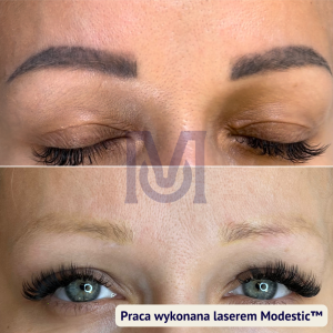 usuwanie makijażu permanentnego