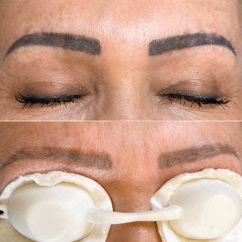 laserowe usuwanie makijażu permanentnego brwi