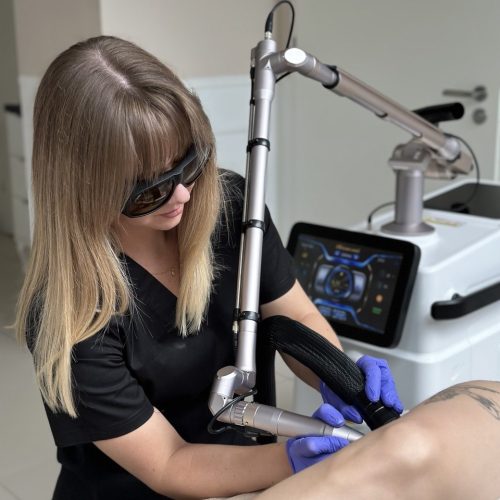 Specjalistka Kristina Malinina wykonuje zabieg usuwania tatuażu laserem w gabinecie kosmetycznym z użyciem nowoczesnego sprzętu kosmetycznego Modestic
