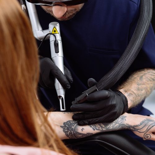 Laser pikosekundowy Do usuwania tatuażu i makijażu permanentnego Modestic Pico